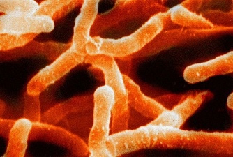Actinomyces to jeden ze szczep&oacute;w bakterii, kt&oacute;rych obecność kontrolowano podczas badań
pl.wikipedia.org/wiki