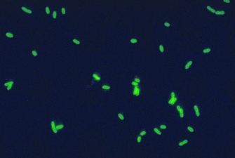 Widok pałeczek Legionella Pneumophila
CDC-PHIL, wikipedia.org/wiki/Legionella