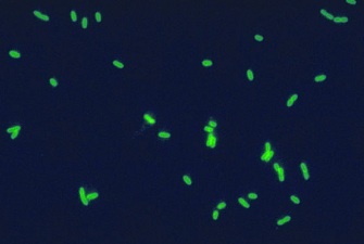 Widok pałeczek Legionella Pneumophila
CDC-PHIL, wikipedia.org/wiki/Legionella