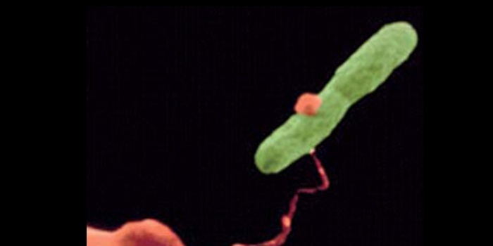 Fot. 1. Bakteria Legionella pneumophila, Fot. ICAM