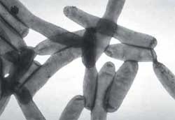 Legionella pneumophila