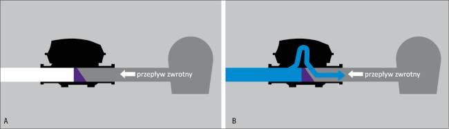 przeplyw zwrotny